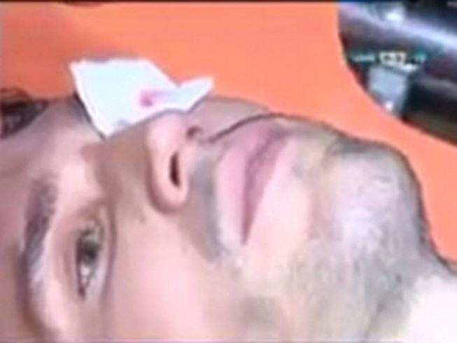 Chấn thương mắt kinh hoàng, Van Persie vẫn nói tôi ổn