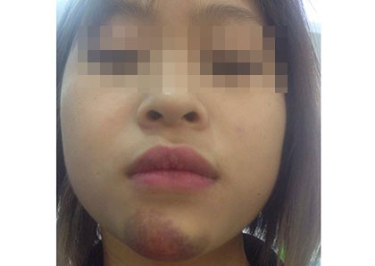 Hành khách “tố” phụ xe buýt hành hung, đuổi khách xuống giữa đường