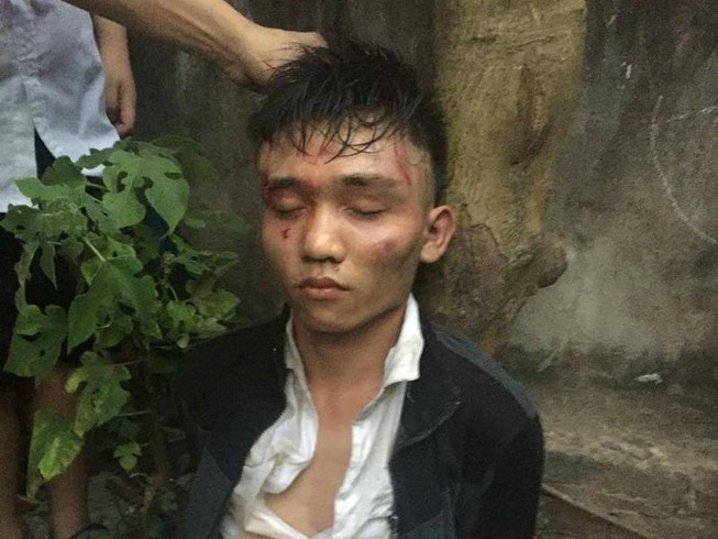 Hà Nội: Táo tợn dùng dao tấn công chủ quán cướp tài sản