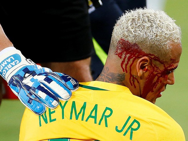 Neymar đổ máu ở Nam Mỹ, trời Âu đau lòng