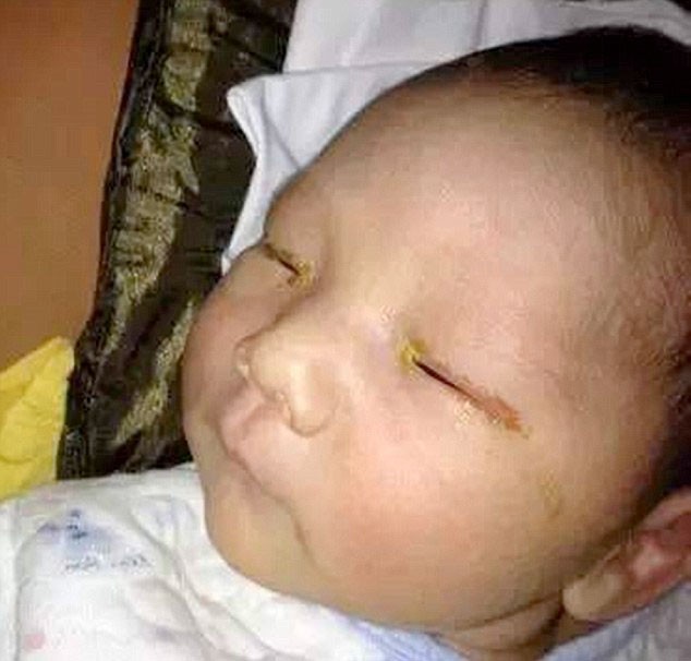 Chụp 'tự sướng', vô tình làm trẻ sơ sinh mù lòa