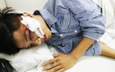 Truy tìm đối tượng ném gạch vào mặt cảnh sát cơ động