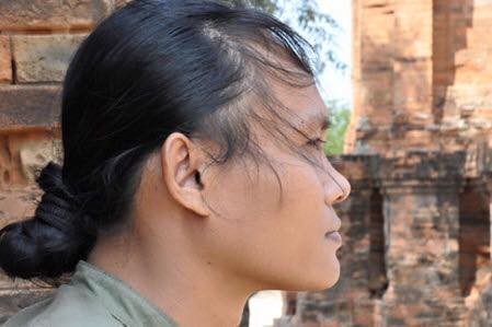 Sáng nay 'thi sĩ chăn bò' phẫu thuật