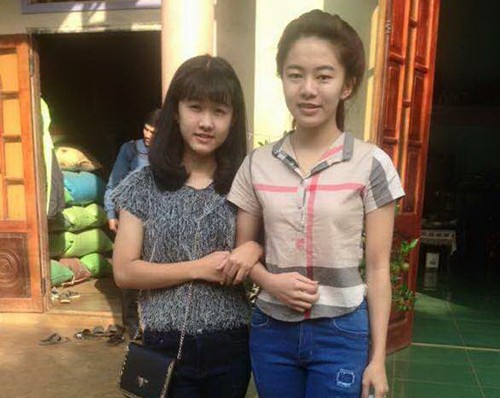Bệnh viện nhận trách nhiệm vì nữ sinh lớp 10 bị cưa chân