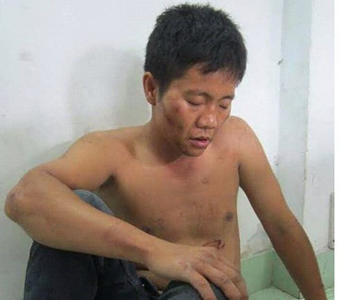 Hai tên trộm rút dao cướp xe khi bị cảnh sát truy đuổi