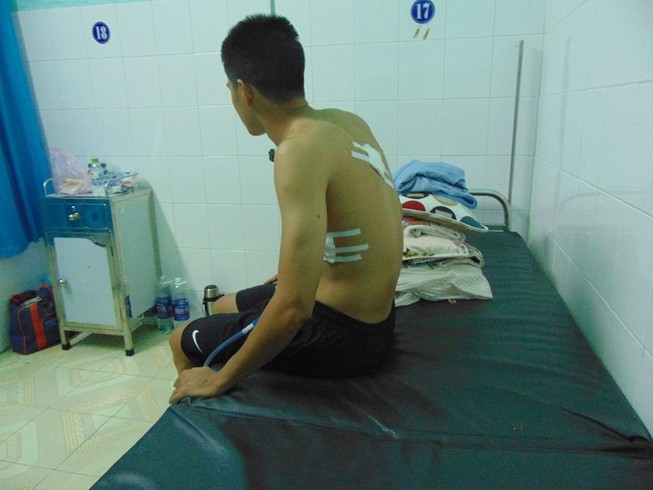 Giận mẹ không cho tiền nhậu, con dùng dao đâm người đi đường