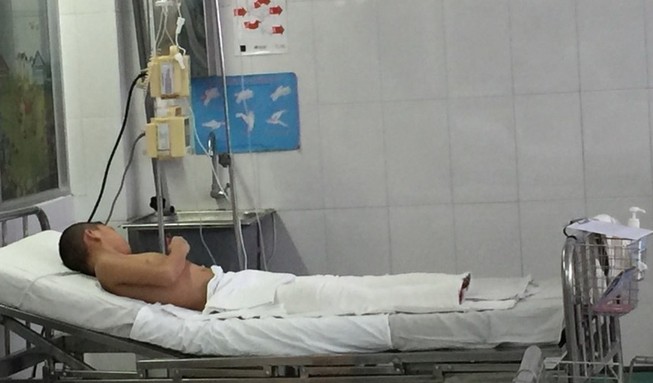 Bé trai tám tuổi bỏng nặng do ngã vào đống trấu đang un