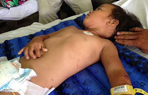 Vụ xe khách gây nạn trên cầu Ba Si, Trà Vinh: Một nạn nhân vẫn hôn mê sâu