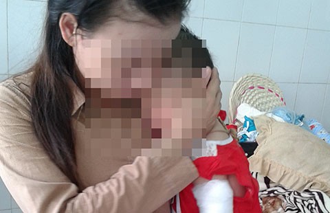 Tiếp nối câu chuyện cháu bé bị cha đốt nhầm