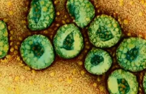 MERS-CoV lây từ người sang người theo cấp số nhân