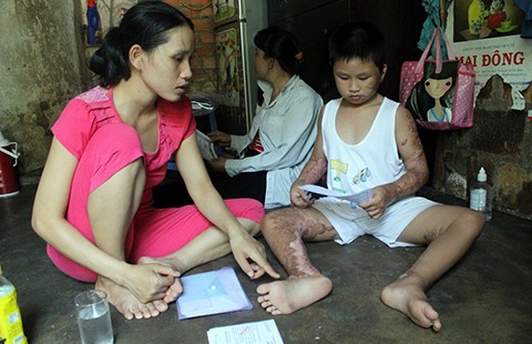 Đứa con trai bị bỏng của bà mẹ ve chai