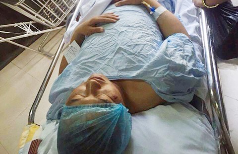 Vi phạm giao thông, đâm trọng thương CSGT