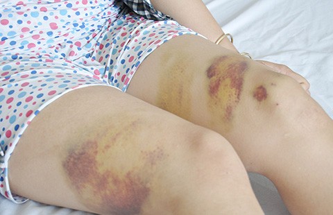 Công an đánh nữ công nhân: ‘Tôi nóng quá’