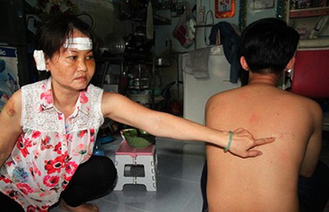 Vụ cầu cứu công an vẫn bị đánh: Truy tìm kẻ đánh người
