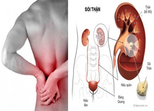 Cách phát hiện sớm bệnh thận