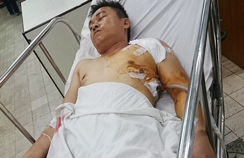 Đâm người trọng thương vẫn chưa bị xử lý