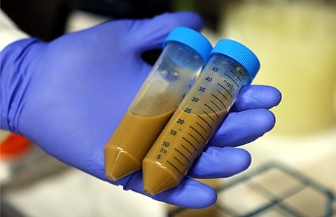 ‘Ngân hàng phân người’ tại Hà Lan