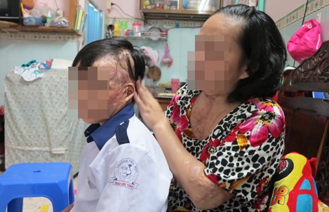 Đau thấu trời vì acid!