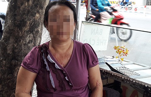 Phải tăng khung phạt với hành vi tạt acid