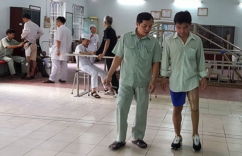 Cải tiến đáng nể cho người lắp chân giả