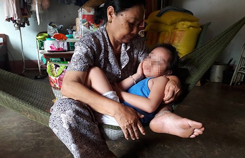 Mất trí nhớ do virus viêm não tấn công