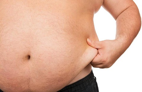 Béo phì đồng nghĩa chết sớm