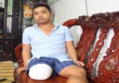 Làm rõ thông tin chẩn đoán sai dẫn tới cưa chân