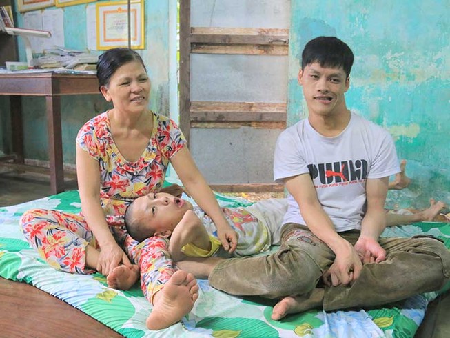 ‘Chàng trai da cam’ vào đại học
