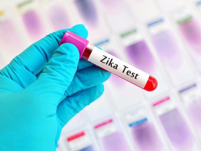 TP.HCM có 38 người nhiễm virus Zika