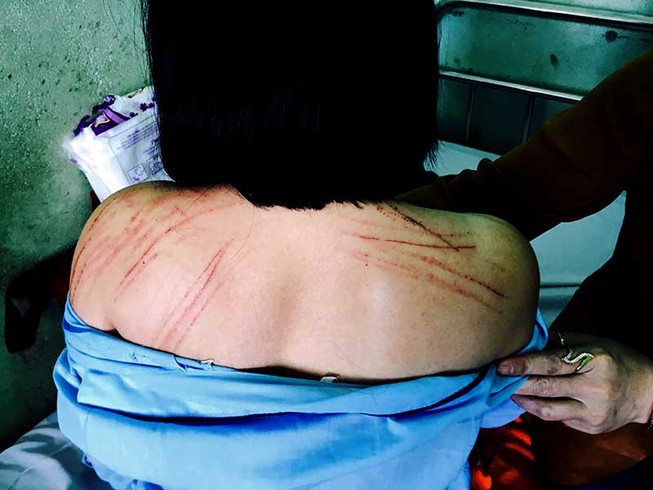 Nữ luật sư tố bị nguyên đơn đánh gãy 2 cái răng