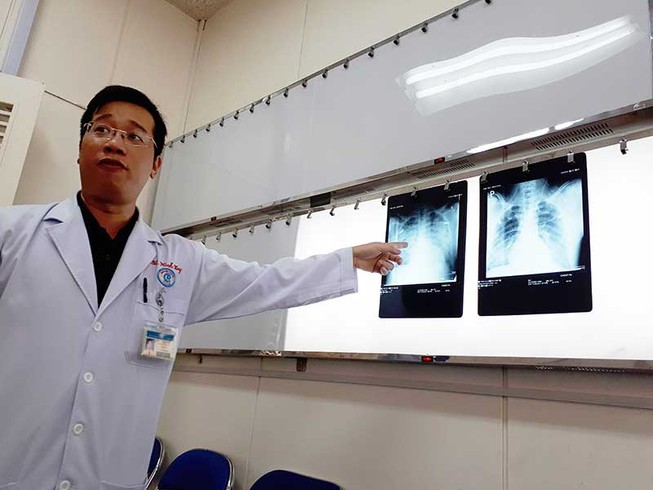 Thực hư virus lạ gây chết người