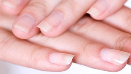 Móng tay bị mủn là bệnh gì?