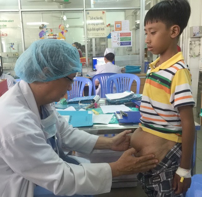 Bé trai có khối bướu bụng to hơn trái banh