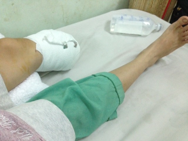 Cô gái trẻ mất một chân khi qua đường