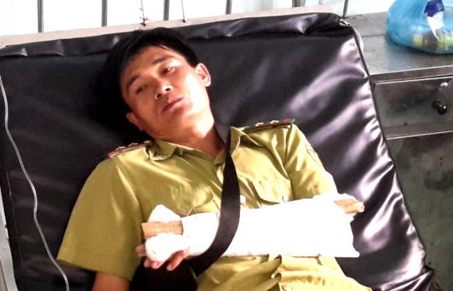 Cán bộ kiểm lâm bị đánh gãy tay khi bảo vệ hiện trường