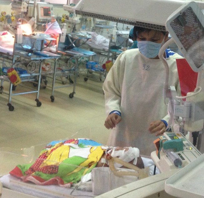 Bé sơ sinh bị đâm vào đầu đã không cần thở máy