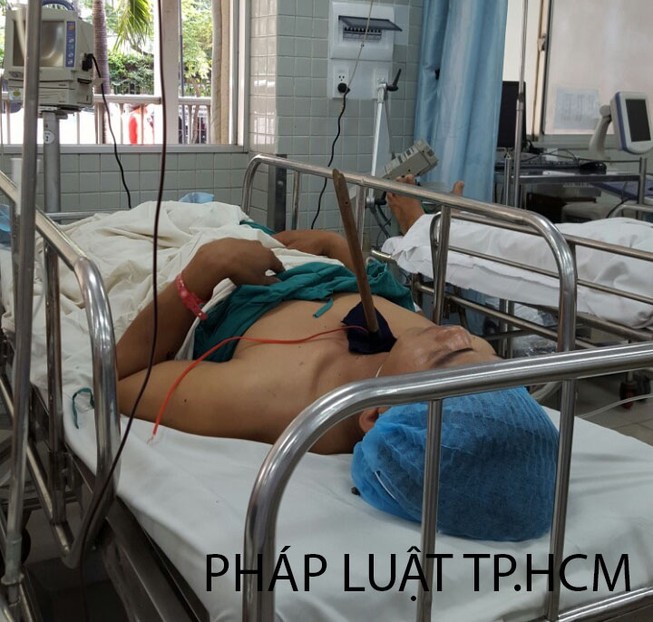 Trộm chó bắn tên vào ngực một dân phòng
