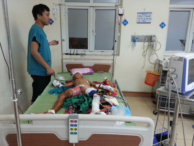 Vật lạ phát nổ, bé trai dập nát tay chân