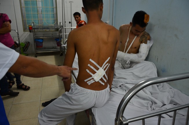 Hai thanh niên bị côn đồ truy sát nhầm tại quán ăn