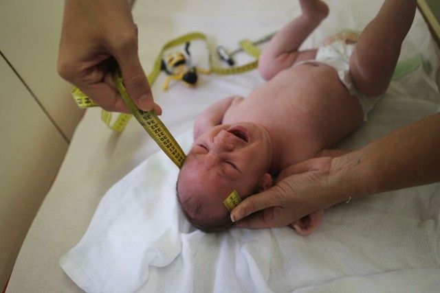 Virus Zika được cảnh báo nguy hiểm hơn mọi người nghĩ