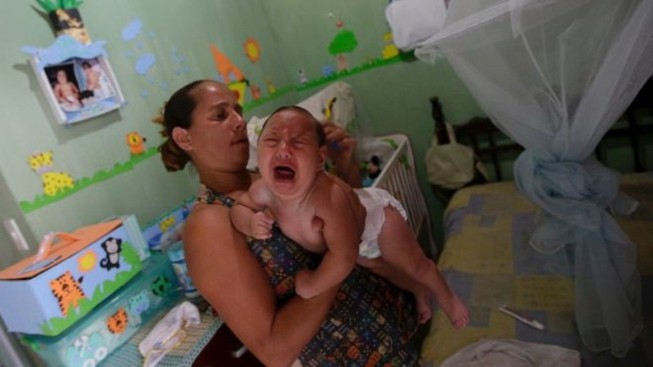 Virus Zika chính là thủ phạm gây teo não