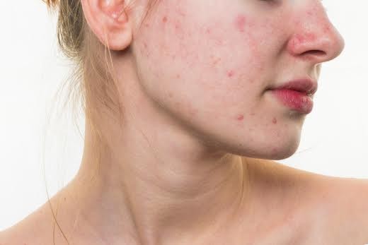 8 biểu hiện trên da báo nguy cho sức khỏe