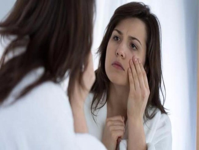 6 lý do làm bạn bị sưng bọng mắt