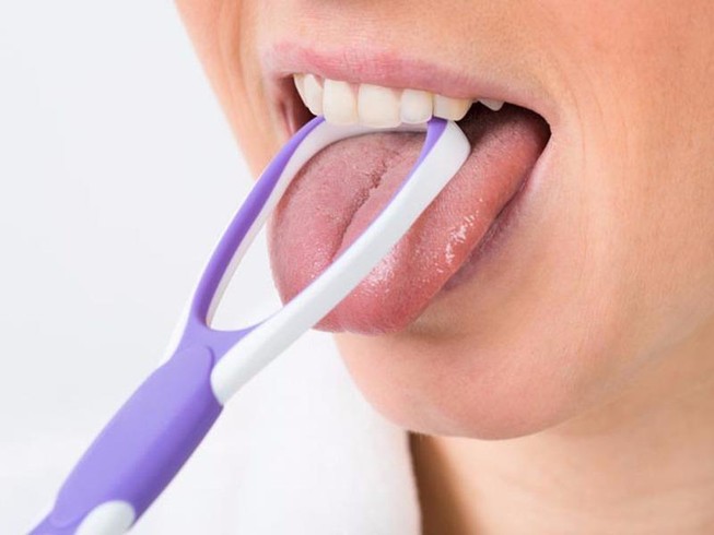 Giật mình trước 5 tác hại khi quên vệ sinh lưỡi