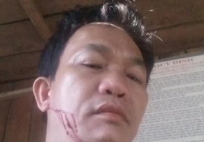 Chở gỗ lậu còn chửi bới rồi chém cán bộ kiểm lâm
