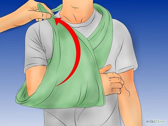 Kinh nghiệm sơ cứu cho người bị tai nạn giao thông