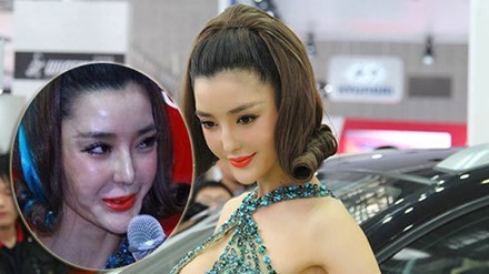 Hàng vạn người tàn phế vì giải phẫu thẩm mỹ