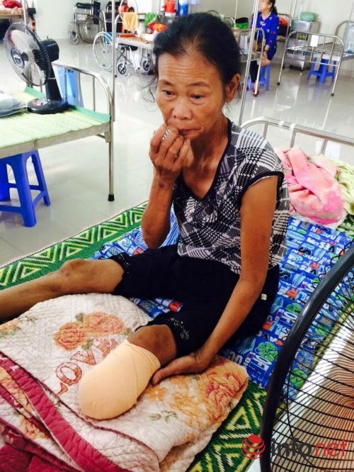 Một tuần bị nhọt, nhập viện bị cắt chân ngay lập tức