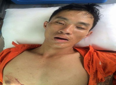 Nghi can trộm xe máy bị người dân lao vào đánh hội đồng