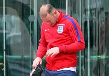 Tóc Wayne Rooney biến mất bí ẩn sau trận thua thảm hại trước Iceland